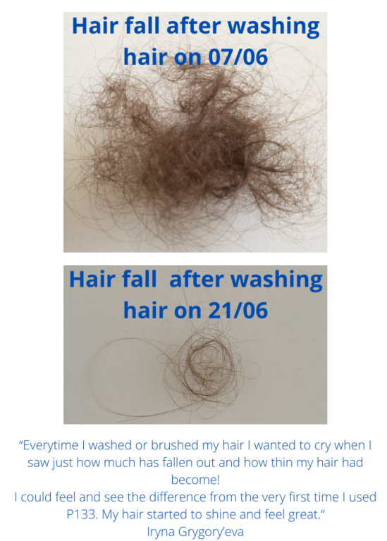 Stop Hair Falling Out