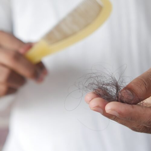 menopause on hair loss
